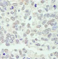 Immunohistochemistry (Formalin/PFA-fixed paraffin-embedded sections) - Anti-KPNA3 antibody (AB84706)