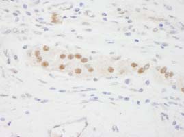 Immunohistochemistry (Formalin/PFA-fixed paraffin-embedded sections) - Anti-KPNA3 antibody (AB84706)