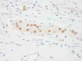 Immunohistochemistry (Formalin/PFA-fixed paraffin-embedded sections) - Anti-KPNA3 antibody (AB84706)