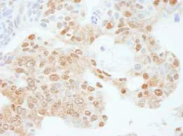 Immunohistochemistry (Formalin/PFA-fixed paraffin-embedded sections) - Anti-KPNA3 antibody (AB84706)