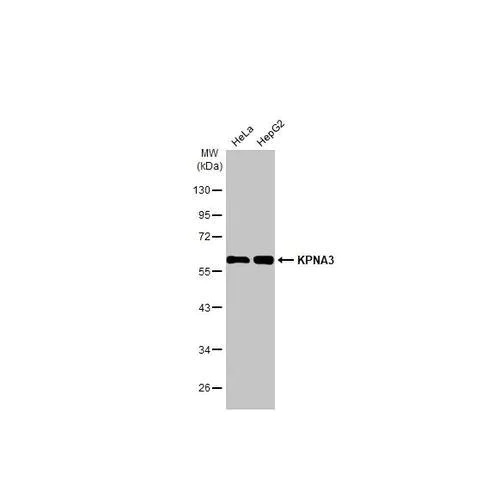 Western blot - Anti-KPNA3 antibody [HL1573] (AB317093)