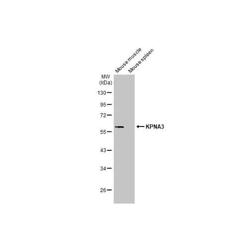 Western blot - Anti-KPNA3 antibody [HL1573] (AB317093)