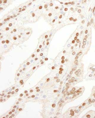 Immunohistochemistry (Formalin/PFA-fixed paraffin-embedded sections) - Anti-KPNA4 antibody (AB176585)