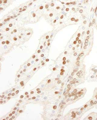 Immunohistochemistry (Formalin/PFA-fixed paraffin-embedded sections) - Anti-KPNA4 antibody (AB176585)