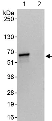 Immunoprecipitation - Anti-KPNA4 antibody (AB176585)