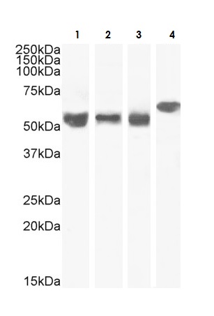 Western blot - Anti-KPNA4 antibody (AB6039)
