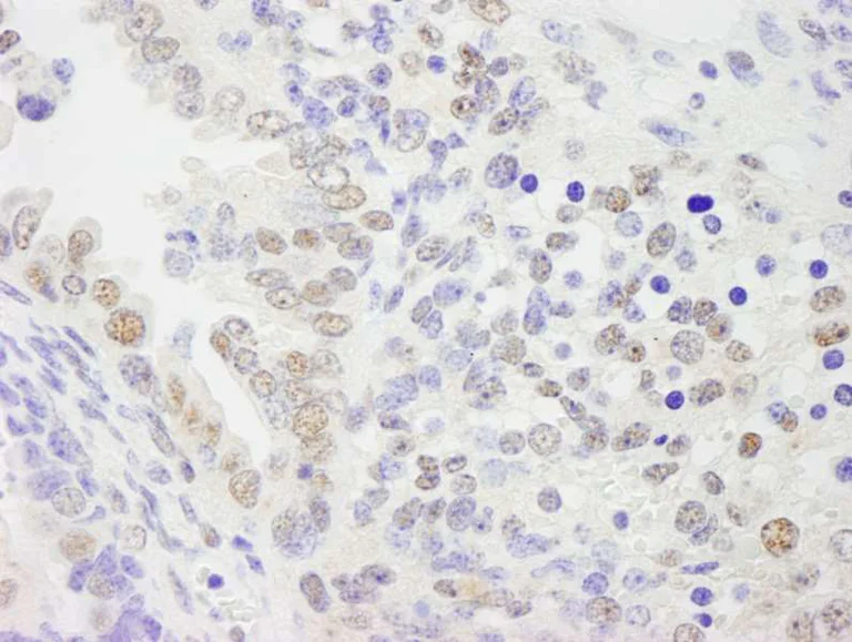 Immunohistochemistry (Formalin/PFA-fixed paraffin-embedded sections) - Anti-KPNA4 antibody (AB84735)