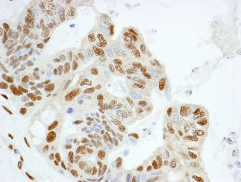 Immunohistochemistry (Formalin/PFA-fixed paraffin-embedded sections) - Anti-KPNA4 antibody (AB84735)