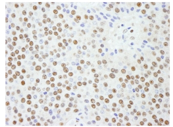 Immunohistochemistry (Formalin/PFA-fixed paraffin-embedded sections) - Anti-KPNA4 antibody (AB84735)