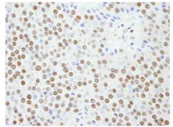 Immunohistochemistry (Formalin/PFA-fixed paraffin-embedded sections) - Anti-KPNA4 antibody (AB84735)