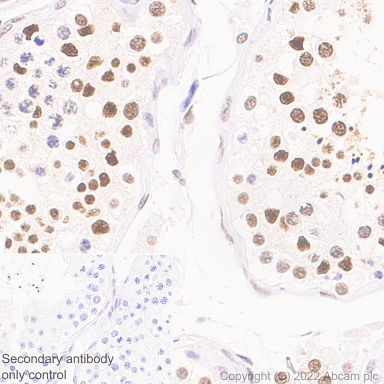 Immunohistochemistry (Formalin/PFA-fixed paraffin-embedded sections) - Anti-KPNA4 antibody [EPR26347-21] - BSA and Azide free (AB302557)