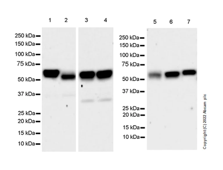 Western blot - Anti-KPNA4 antibody [EPR26347-21] - BSA and Azide free (AB302557)
