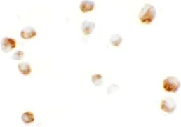 Immunocytochemistry - Anti-KPNA5 antibody - N-terminal (AB189987)