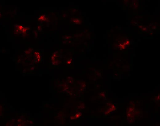 Immunocytochemistry/ Immunofluorescence - Anti-KPNA5 antibody - N-terminal (AB189987)