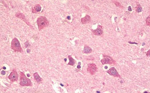 Immunohistochemistry (Formalin/PFA-fixed paraffin-embedded sections) - Anti-KPNA5 antibody - N-terminal (AB189987)