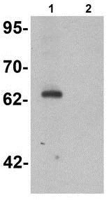Western blot - Anti-KPNA5 antibody - N-terminal (AB189987)