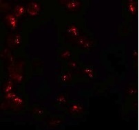 Immunocytochemistry/ Immunofluorescence - Anti-KPNA6 antibody (AB105350), expandable thumbnail