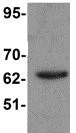 Western blot - Anti-KPNA6 antibody (AB105350)