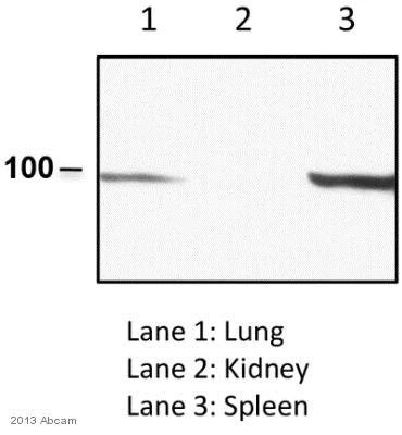 Western blot - Anti-KPNB1 antibody [3E9] (AB2811)