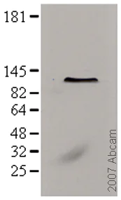 Western blot - Anti-KPNB1 antibody [3E9] (AB2811)