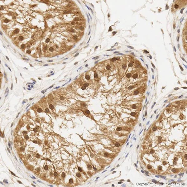 Immunohistochemistry (Formalin/PFA-fixed paraffin-embedded sections) - Anti-KPNB1 antibody (AB45938)