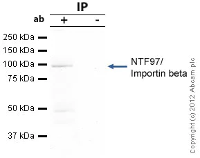 Immunoprecipitation - Anti-KPNB1 antibody (AB45938)