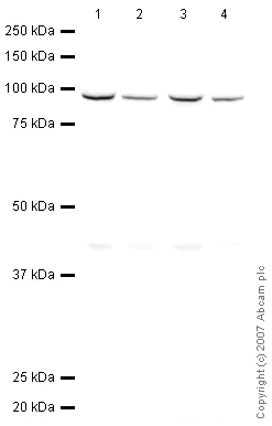 Western blot - Anti-KPNB1 antibody (AB45938)