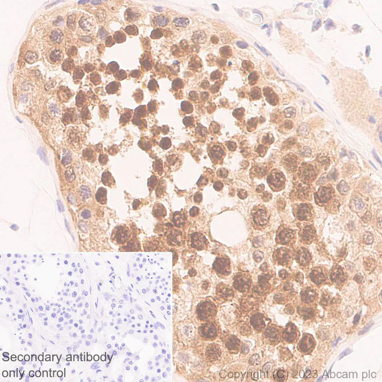 Immunohistochemistry (Formalin/PFA-fixed paraffin-embedded sections) - Anti-KPNB1 antibody [EPR26137-52] (AB313370)