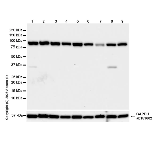 Western blot - Anti-KPNB1 antibody [EPR26137-52] (AB313370)