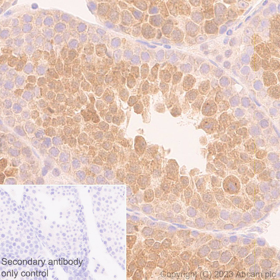 Immunohistochemistry (Formalin/PFA-fixed paraffin-embedded sections) - Anti-KPNB1 antibody [EPR26137-52] - BSA and Azide free (ab313371), expandable thumbnail