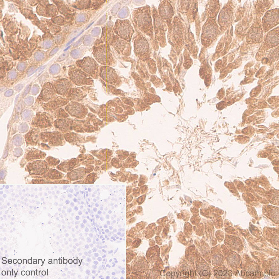 Immunohistochemistry (Formalin/PFA-fixed paraffin-embedded sections) - Anti-KPNB1 antibody [EPR26137-52] - BSA and Azide free (ab313371), expandable thumbnail