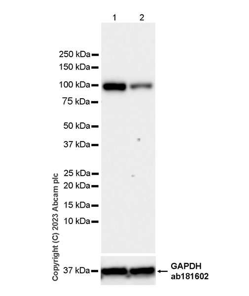 Western blot - Anti-KPNB1 antibody [EPR26137-52] - BSA and Azide free (AB313371), expandable thumbnail