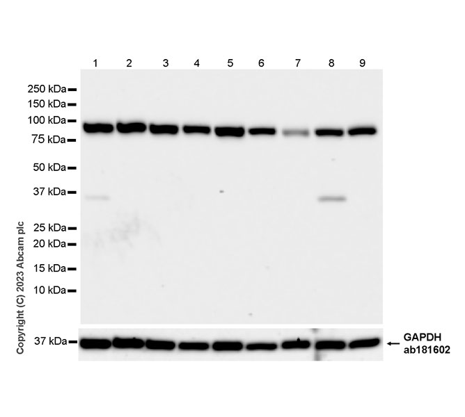 Western blot - Anti-KPNB1 antibody [EPR26137-52] - BSA and Azide free (AB313371), expandable thumbnail