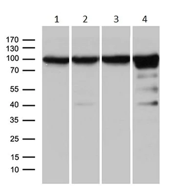 Western blot - Anti-KPNB1 antibody [OTI6H3] (AB236508)