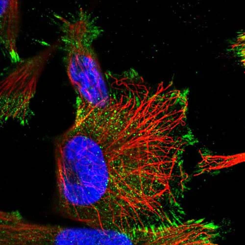 Immunocytochemistry/ Immunofluorescence - Anti-KPRP antibody (AB122201)