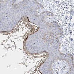 Immunohistochemistry (Formalin/PFA-fixed paraffin-embedded sections) - Anti-KPRP antibody (AB122201), expandable thumbnail