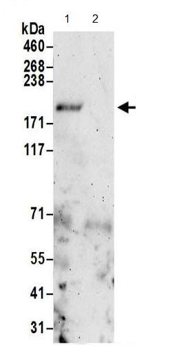 Immunoprecipitation - Anti-KRAP antibody (AB195334)