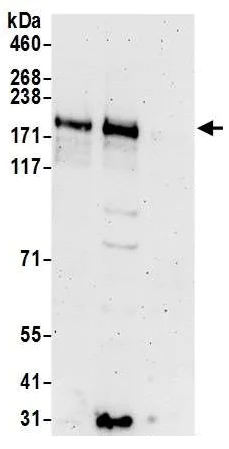 Western blot - Anti-KRAP antibody (AB195334)