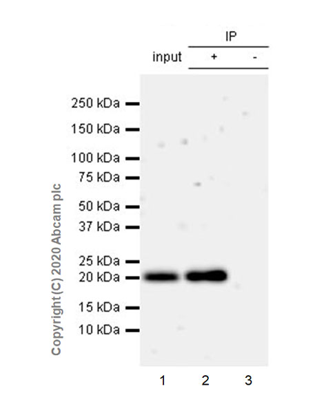 Immunoprecipitation - Anti-KRAS antibody [EPR23474-76] (AB275876)