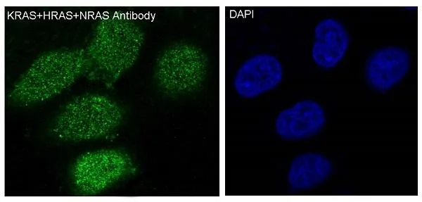 Immunocytochemistry/ Immunofluorescence - Anti-KRAS + HRAS + NRAS antibody [SR1329] (AB326684)