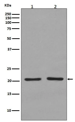 Western blot - Anti-KRAS + HRAS + NRAS antibody [SR1329] (AB326684)