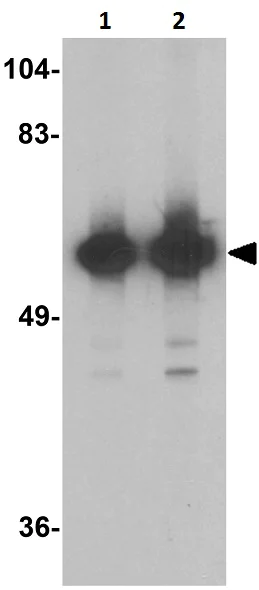 Western blot - Anti-KREMEN1 antibody - C-terminal (AB211285)