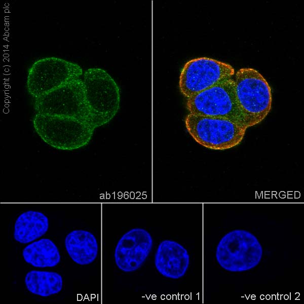 Immunocytochemistry/ Immunofluorescence - Anti-KRIT1 antibody [EPR16560] (AB196025)