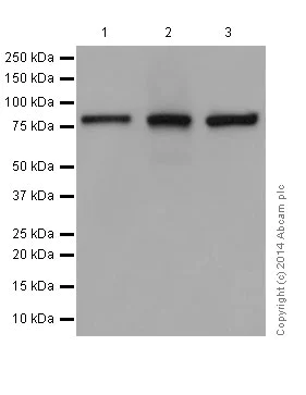 Western blot - Anti-KRIT1 antibody [EPR16560] (AB196025)