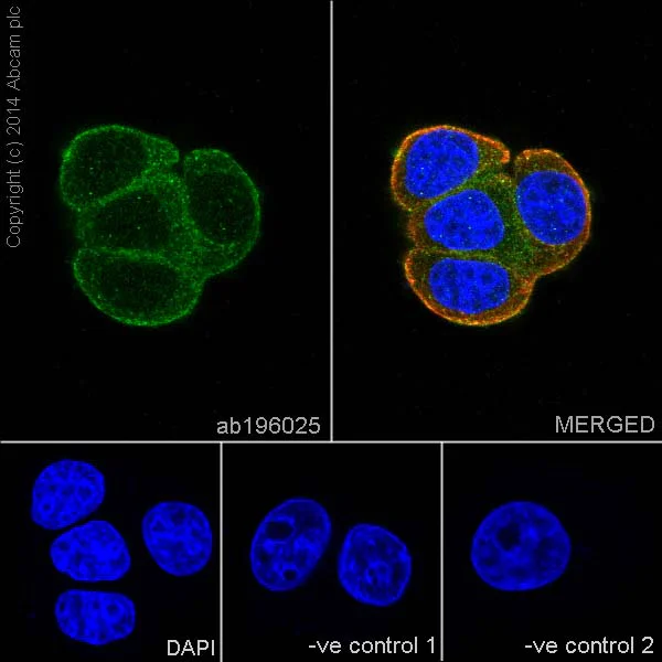 Immunocytochemistry/ Immunofluorescence - Anti-KRIT1 antibody [EPR16560] - BSA and Azide free (AB240339)