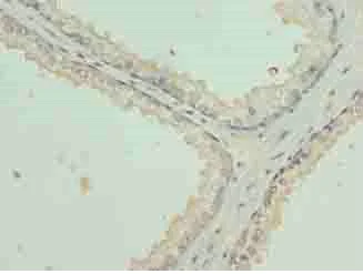 Immunohistochemistry (Formalin/PFA-fixed paraffin-embedded sections) - Anti-KRT35 antibody (AB235356)