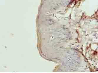 Immunohistochemistry (Formalin/PFA-fixed paraffin-embedded sections) - Anti-KRT35 antibody (AB235356)