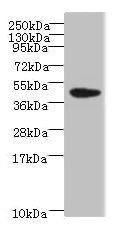 Western blot - Anti-KRT35 antibody (AB235356)