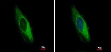 Immunocytochemistry/ Immunofluorescence - Anti-KRT6B antibody (AB154313), expandable thumbnail