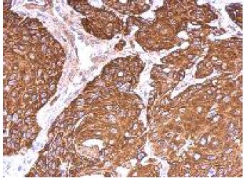 Immunohistochemistry (Formalin/PFA-fixed paraffin-embedded sections) - Anti-KRT6B antibody (AB154313), expandable thumbnail